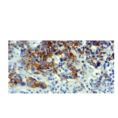 Cytokeratin 7 (LP1K) Cytokeratin 7 (LP1K)