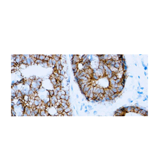 E-Cadherin (SPM471)