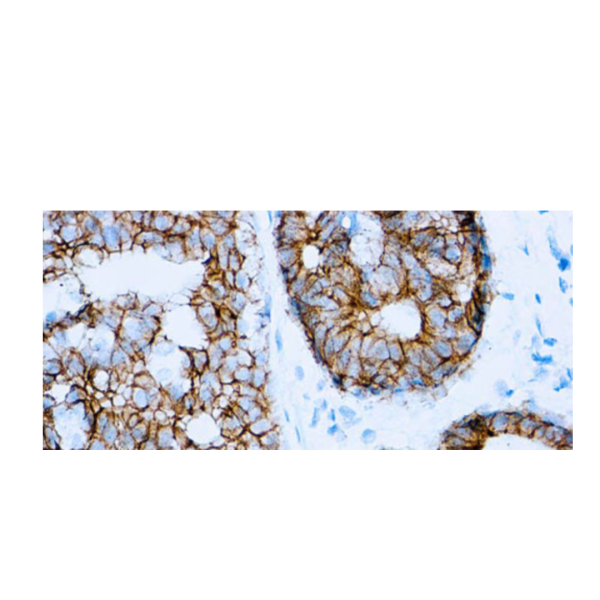 E-Cadherin (SPM471) E-Cadherin (SPM471)
