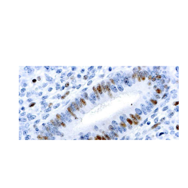 E2F-1 Transcription Factor E2F-1 Transcription Factor