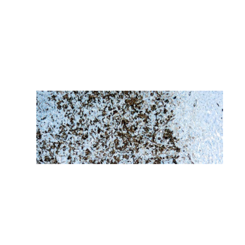 Fascin-1 Fascin-1