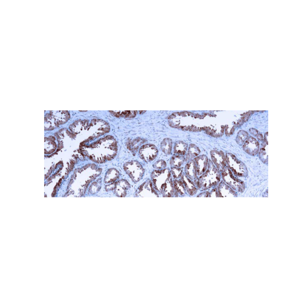 Galectin-3