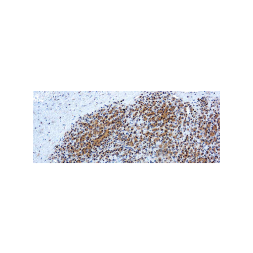 Glypican-3 (GPC3) Glypican-3 (GPC3)