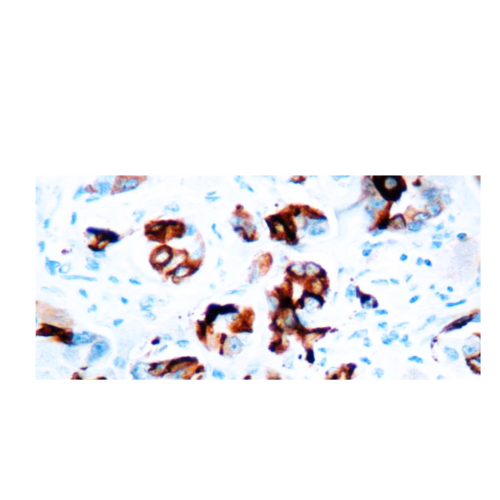 Mammaglobina A