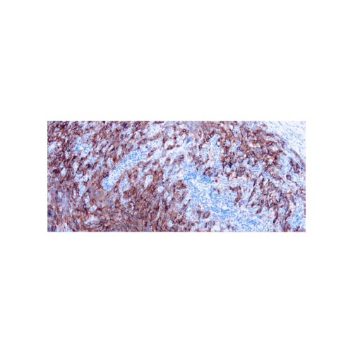 Melanoma Cocktail Antibody