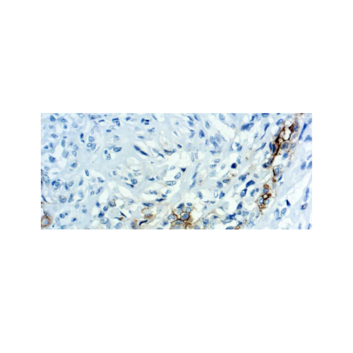 Mesothelin