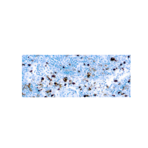 Mieloperoxidasa Mieloperoxidasa