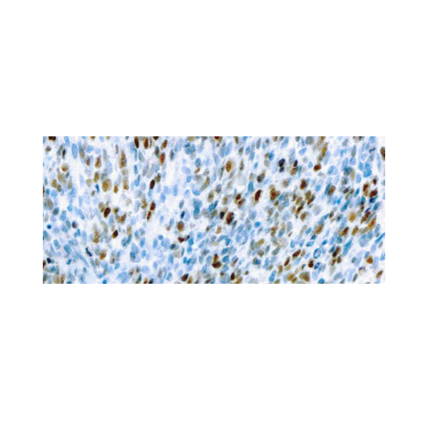 MyoD1 MyoD1