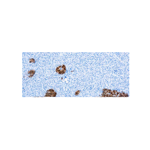 Neuron Specific Enolase, NSE Neuron Specific Enolase, NSE