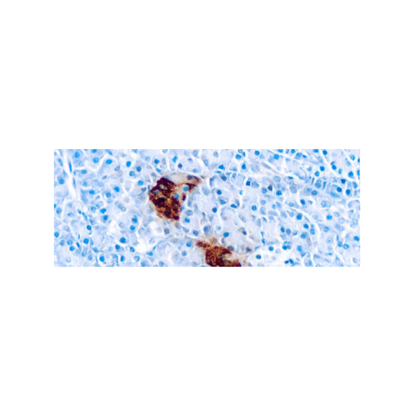 Pancreatic Polypeptide