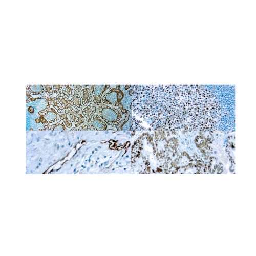 Panel gastrico Panel gastrico