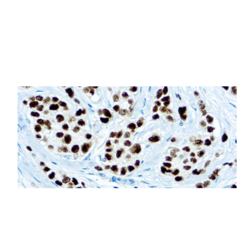 Progesterone Receptor (SP2)