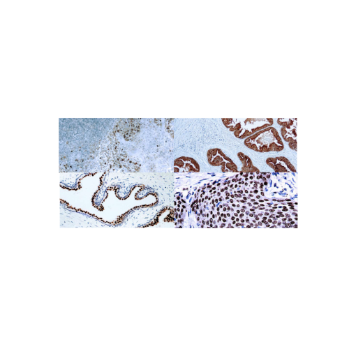 Prostata Prostata