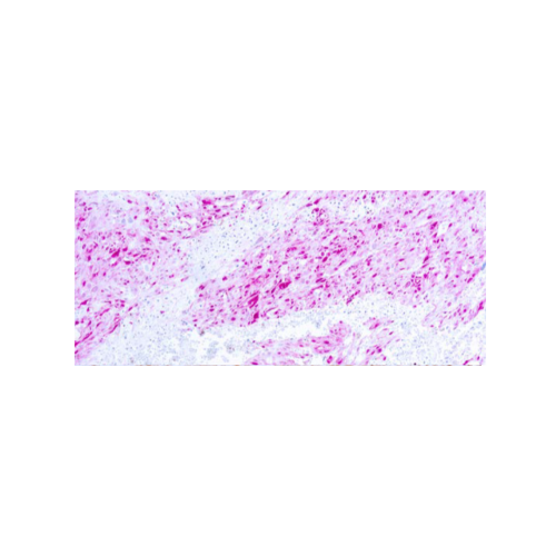 S-100 Protein