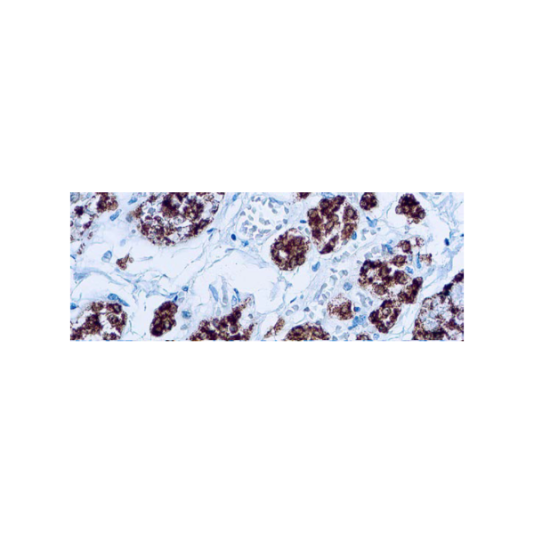 Thyroid Peroxidase