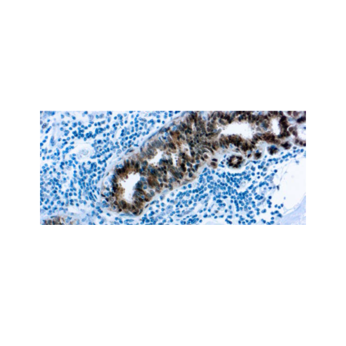 Proteína de Choque Térmico Proteína de Choque Térmico