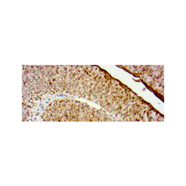 Uroplakin II Uroplakin II