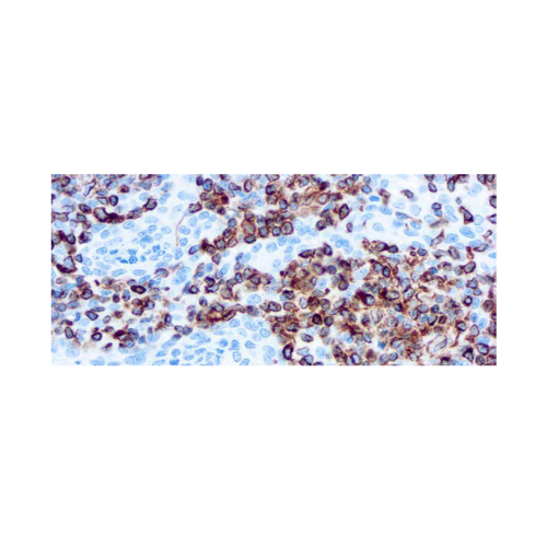 Vimentin