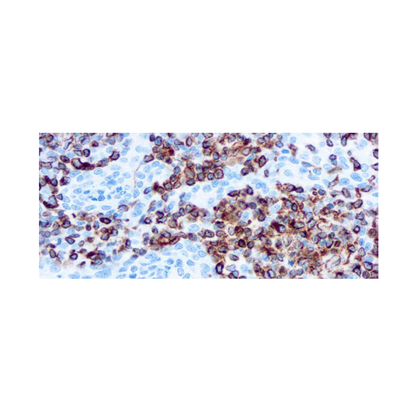 Vimentin