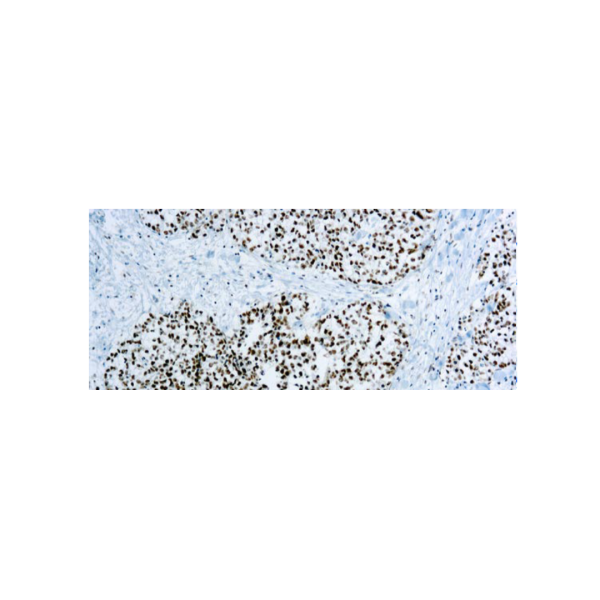 XRCC1